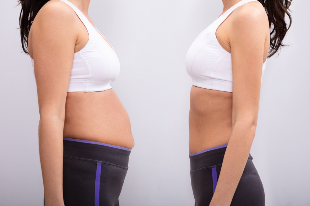 How to Get the Best Results From Your Tummy Tuck