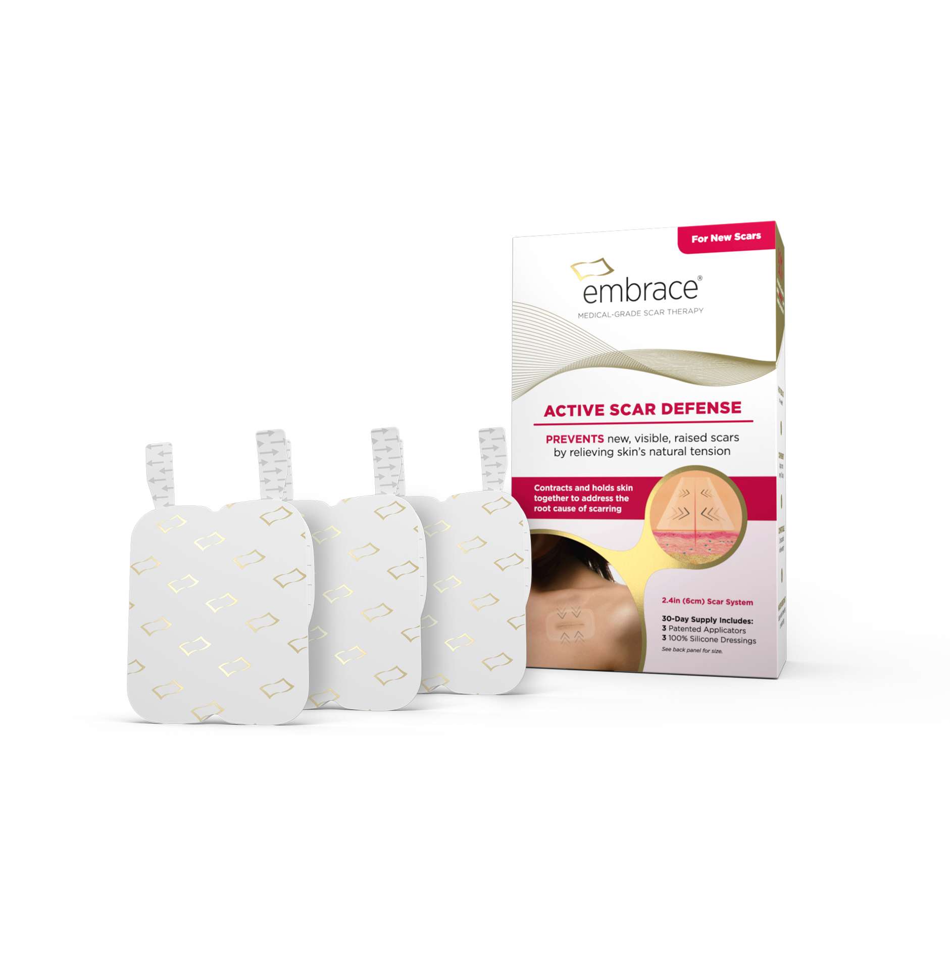 Liposuction Scars  Treatment with embrace® Scar Therapy