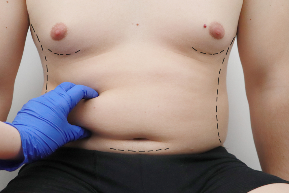 Man's stomach being pinched by